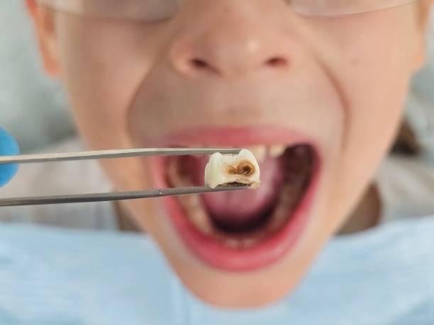Best Urgent Dental Care for Toothache in Passapatanzy, VA